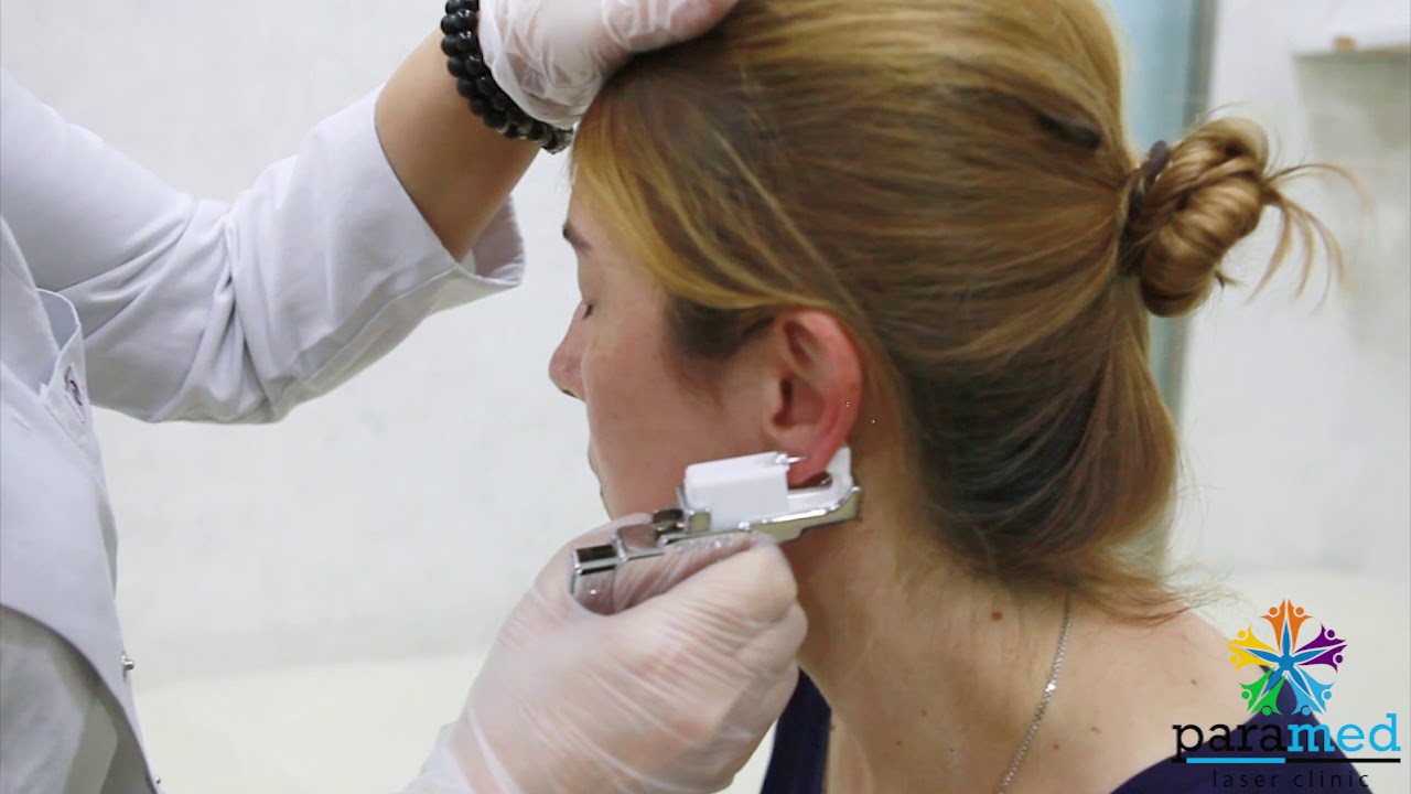 Paramed Klinikasında Studex System 75 ilə qulaq deşilməsi, Bakı